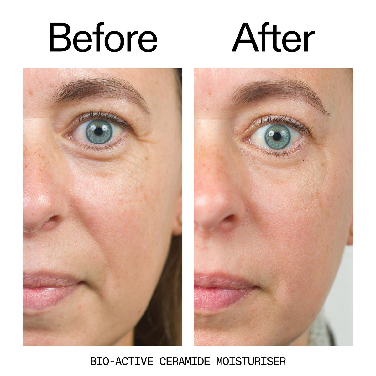 barrier-boosting-trio-f8 Bio-Active_Before_After_2000x2000_600947b4-e8c5-425a-9155-fc15bc83aa12.jpg