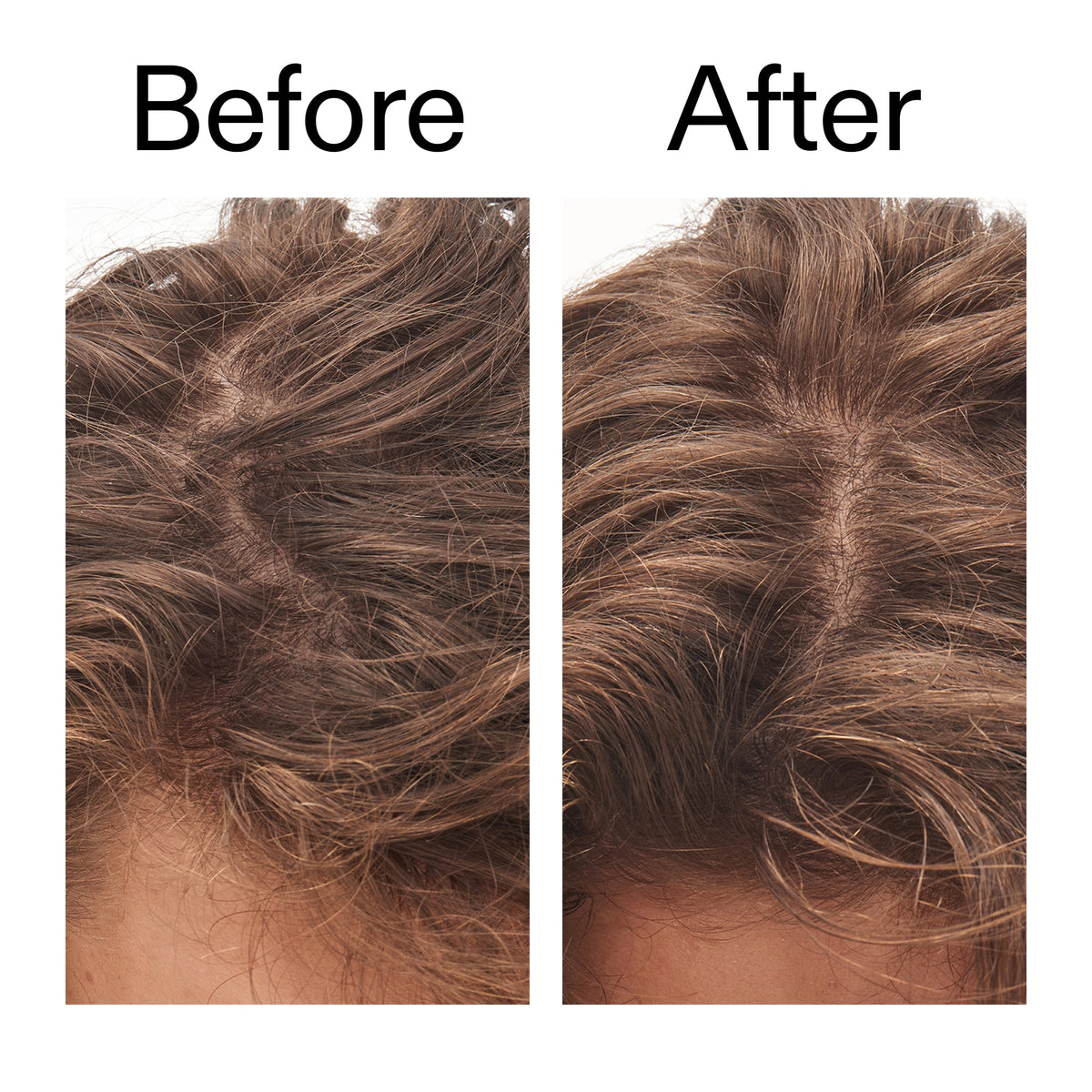 glycolic-acid-exfoliating-scalp-scrub-i7 Glycolic_Acid_Exfoliating_Scalp_Scrub_Before_After_2000x2000_b8561c87-05a1-4caa-80f7-1b6b33d750f7.jpg