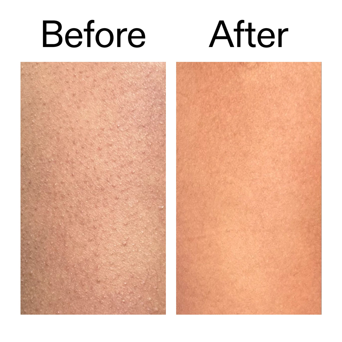 glycolic-acid-exfoliating-body-stick-w6 Glycolic_Body_Stick_B_A_2000x2000_6e6e6b4d-5bd7-43c0-aeed-4d66788e8995.jpg