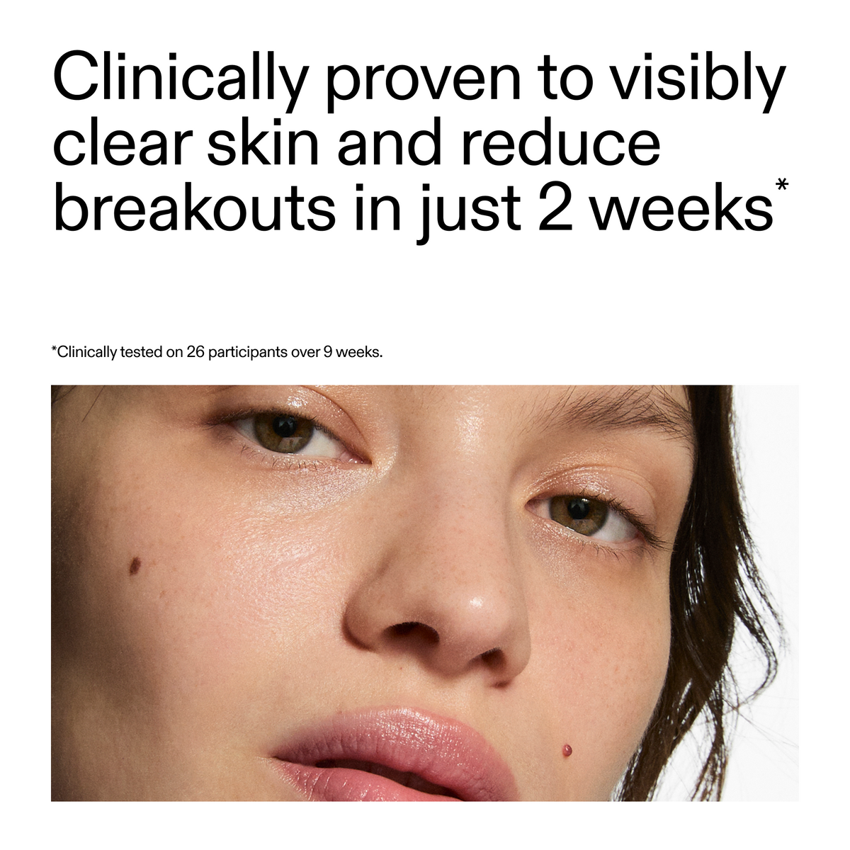 360-acne-clearing-serum-t8 360_Serum_Key_Claim.png
