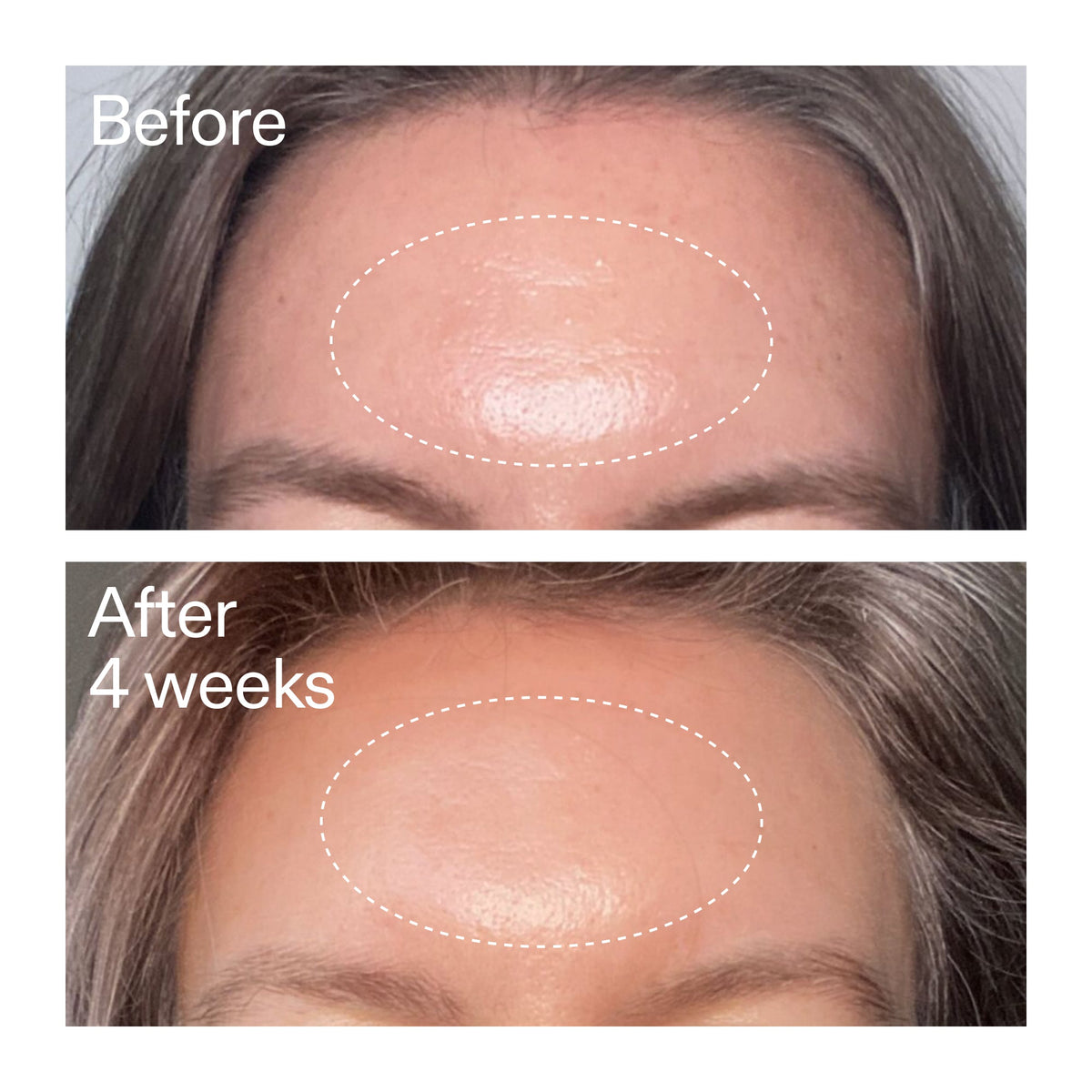 advanced-0-2-retinal-serum-duo-l9 AdvancedRetinal_BeforeAfter1_2000x2000_4e9c798a-f30e-45b8-a34a-7c4740f2f2cb.jpg