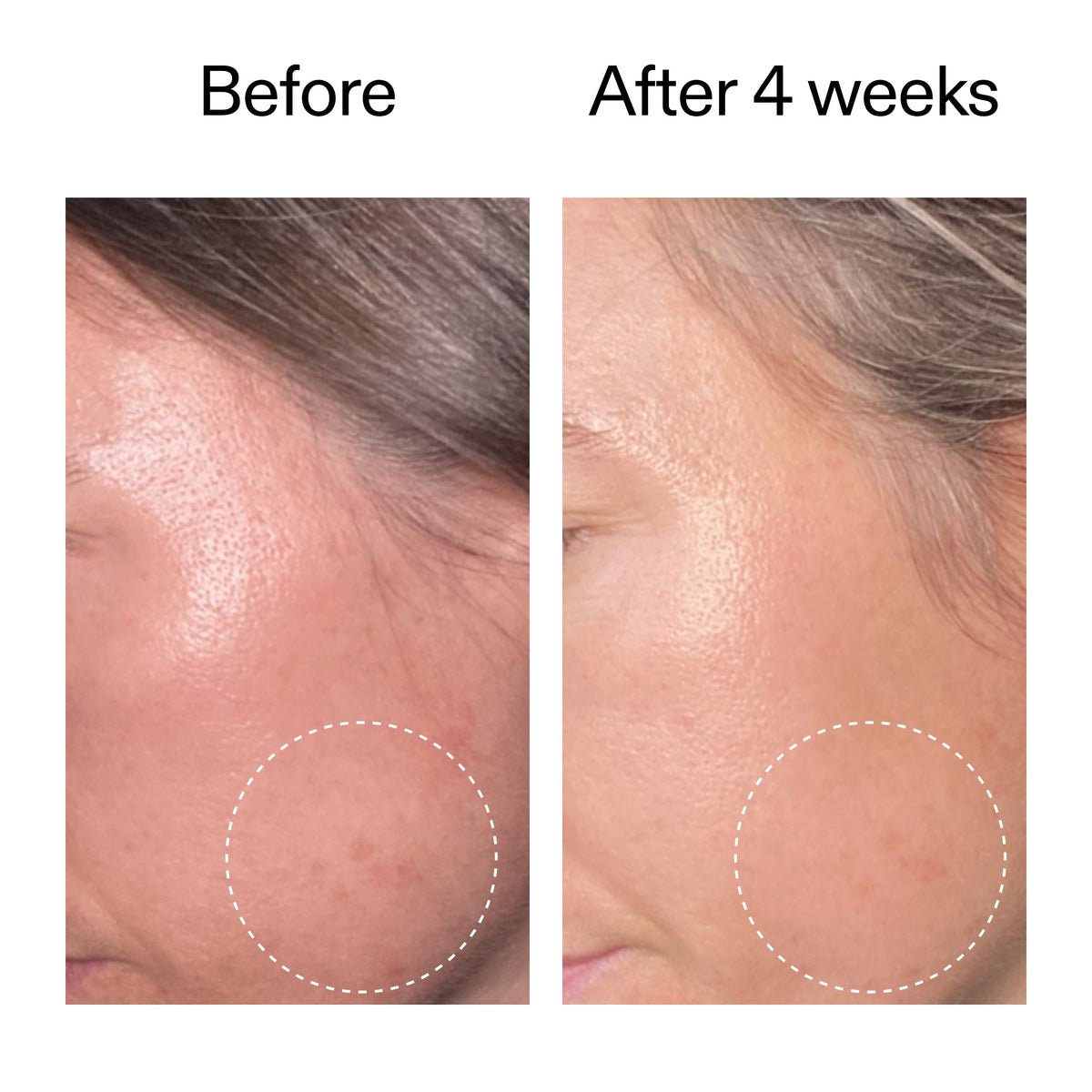 advanced-0-2-retinal-serum-g1 AdvancedRetinal_BeforeAfter2__2000x2000_62fb16bb-77ae-4d63-8500-88dbf847f4b9.jpg