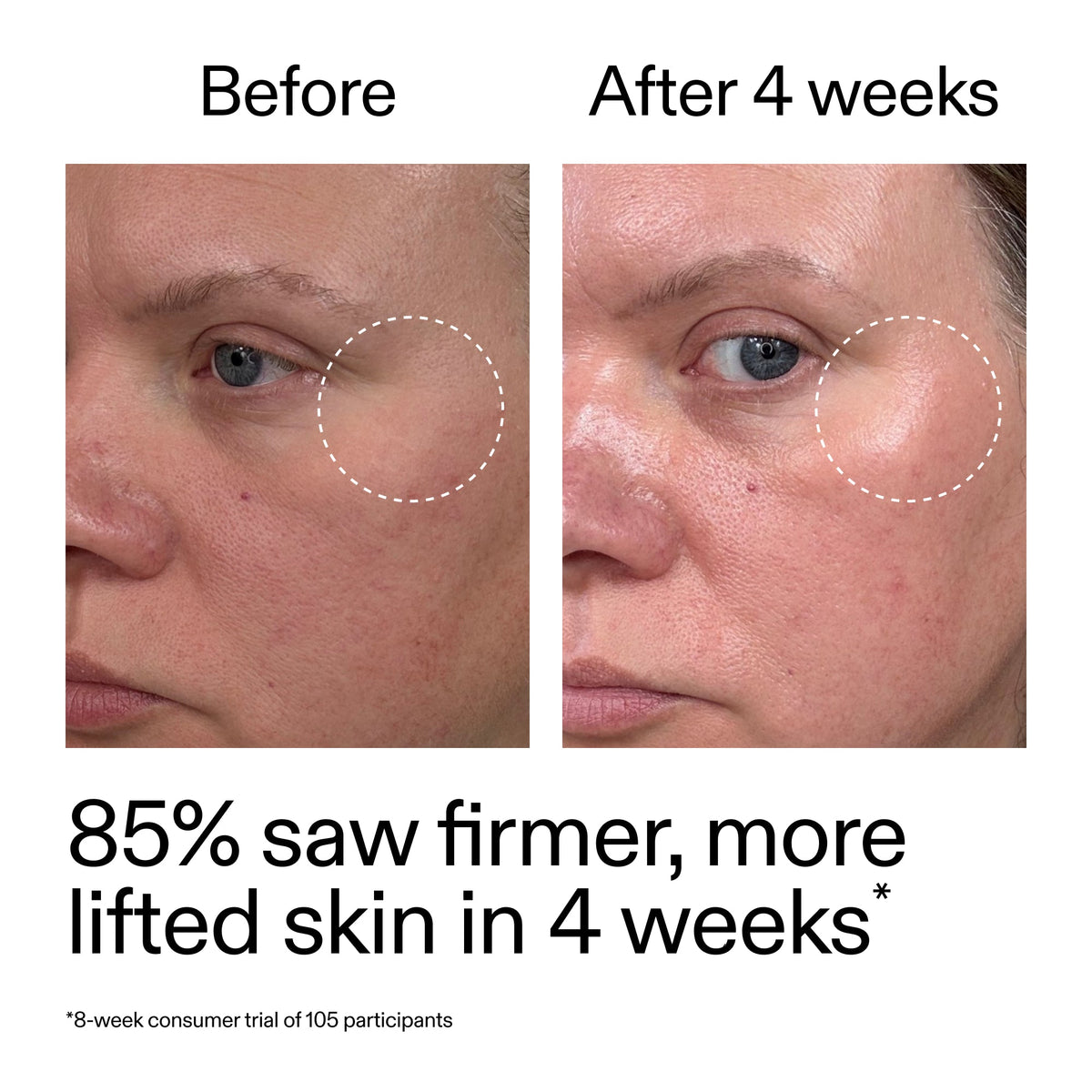 advanced-0-2-retinal-serum-duo-l9 AdvancedRetinal_BeforeAfter_Claim1_2000x2000_3a315aa8-f408-4b33-bbeb-0d9209f98404.jpg