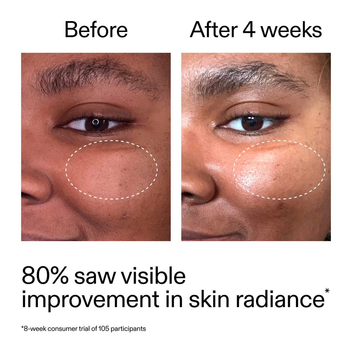 advanced-0-2-retinal-serum-g1 AdvancedRetinal_BeforeAfter_Claim2_2000x2000_39d11e3d-eda9-44ec-ab32-2903b1a368bd.jpg
