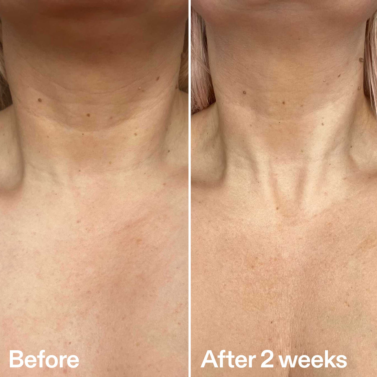 bio-active-neck-lift-stick-h7 B_A_2.jpg