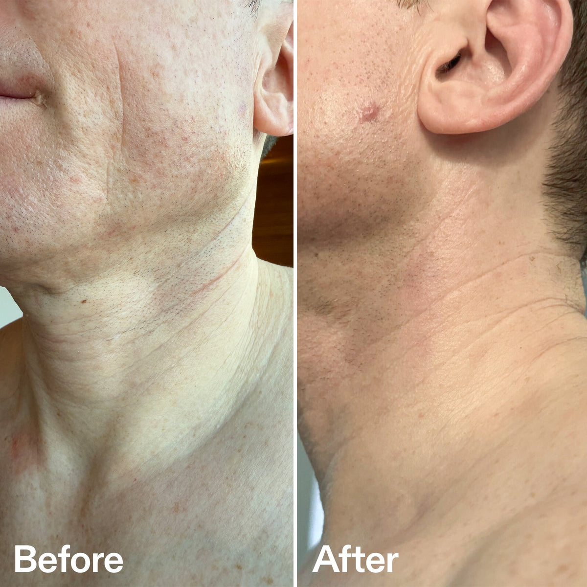 bio-active-neck-lift-stick-h7 B_A_afa2743e-b8e2-4504-92f4-e281cb6cf759.jpg