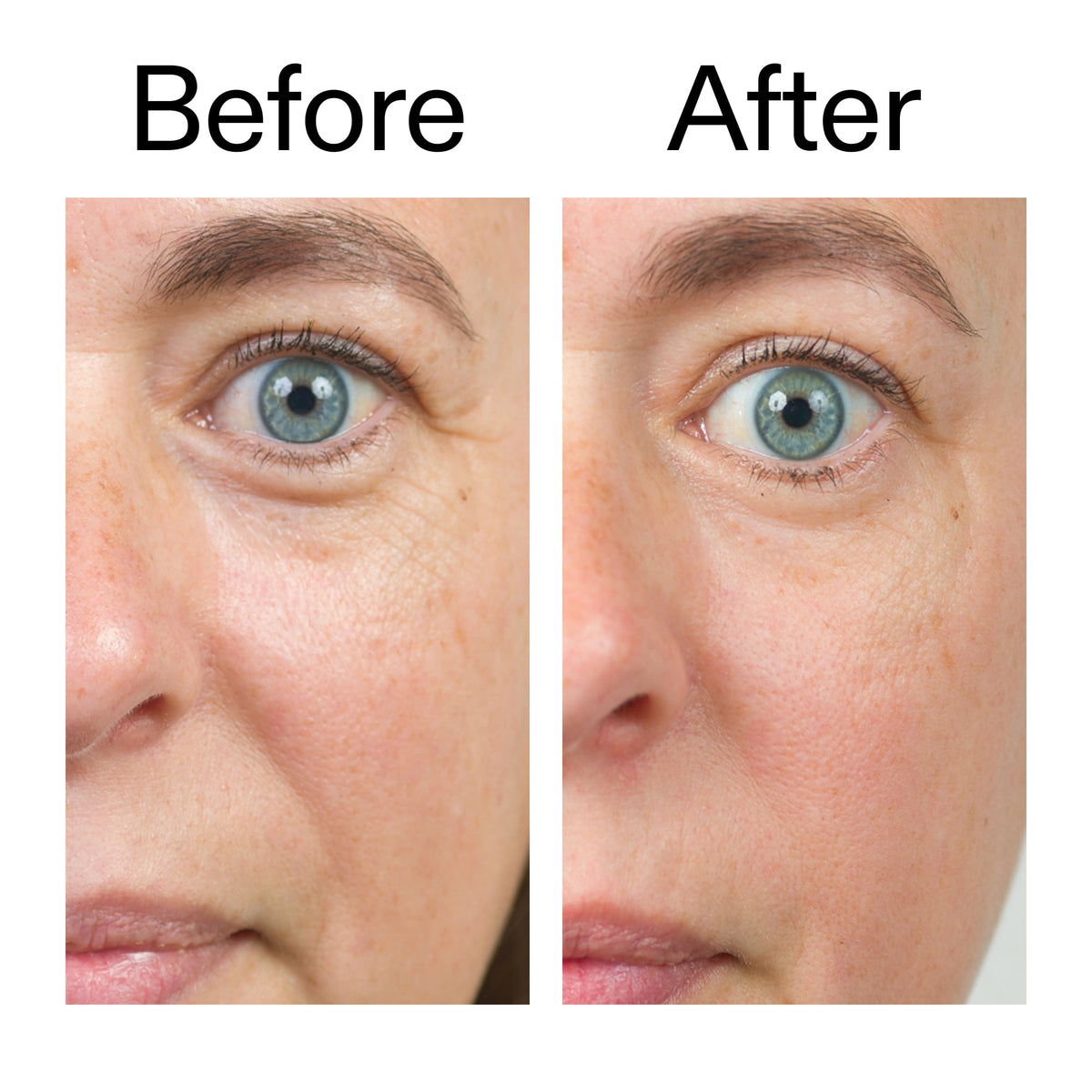 bio-active-ceramide-moisturizer-duo-e7 Bio-Active_Before_After_2000x2000_566e5a9e-135e-417a-8242-b44e5fa35463.jpg