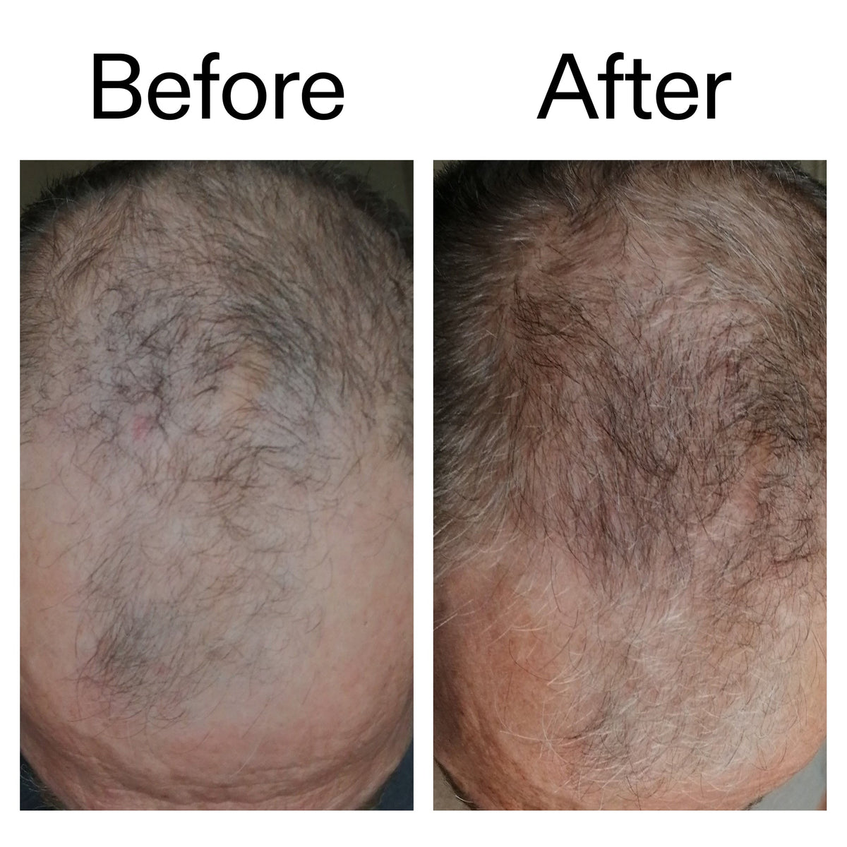 caffeine-stimulating-scalp-treatment-h3 Caffeine_Scalp_Treatment_B_A_Ppage_2000_x_2000.jpg