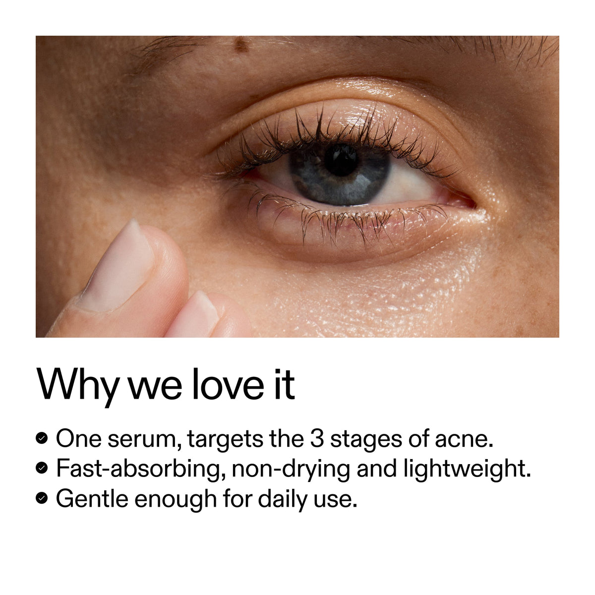 360-acne-clearing-duo-e2 Dioic_Whyweloveit_2000x2000_175aafd3-0cbe-403a-b317-a8362881bfe2.jpg