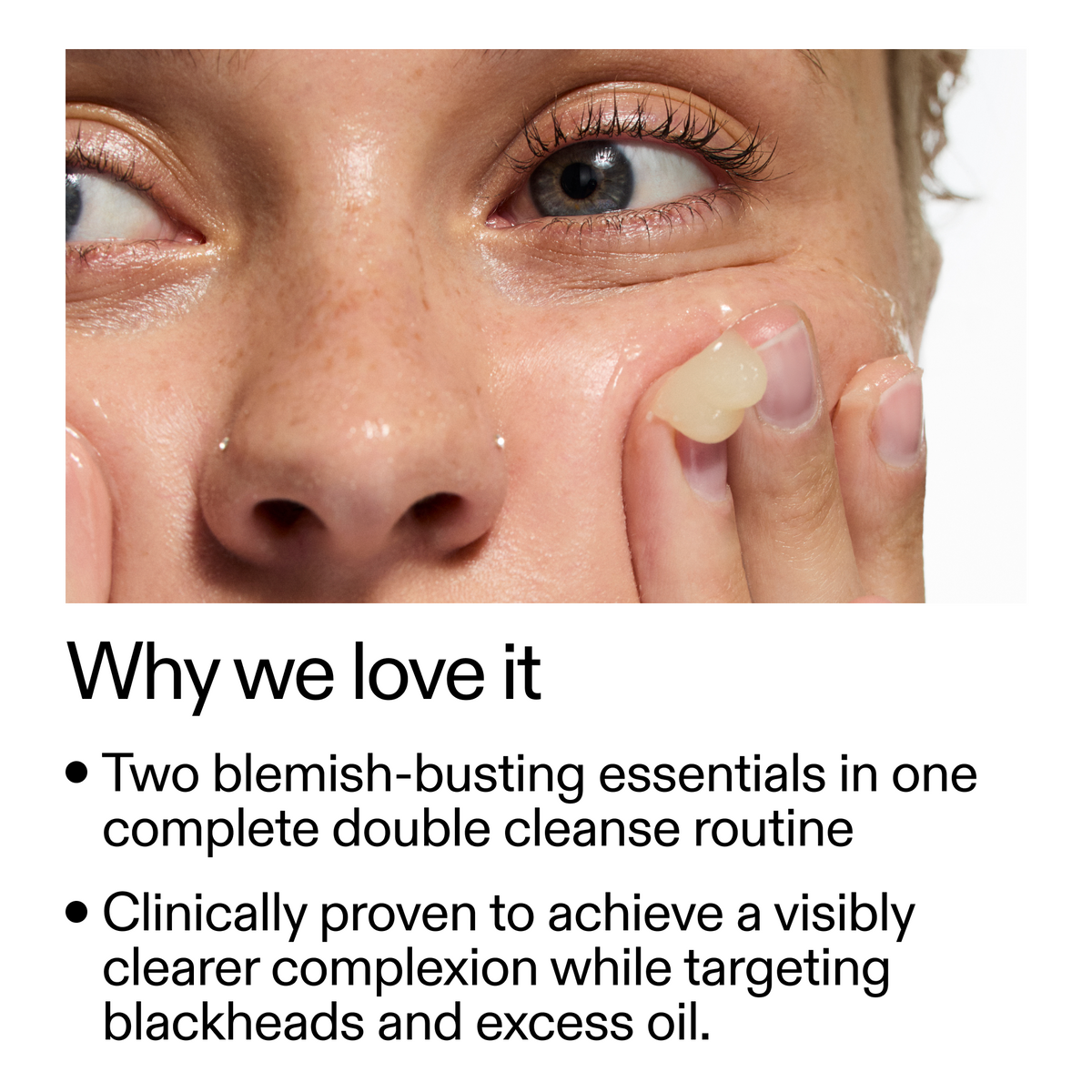 acne-double-cleanse-duo-v5 Double_Cleanse_Duo_for_Breakouts_Why_We_2000x2000_f242cb12-bb5c-487c-b203-071ccb406ec5.png