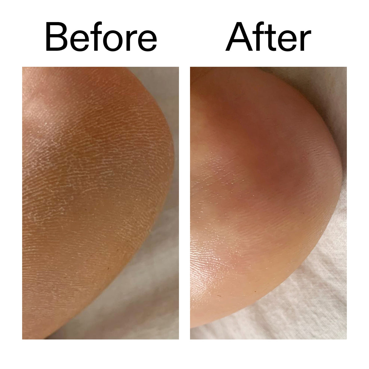 glycolic-acid-exfoliating-body-stick-w6 Glycolic_Acid_Exfoliating_Body_Stick_Before_After_V1_2000x2000_a3043625-9400-429a-a7fb-d6dbd220f722.jpg