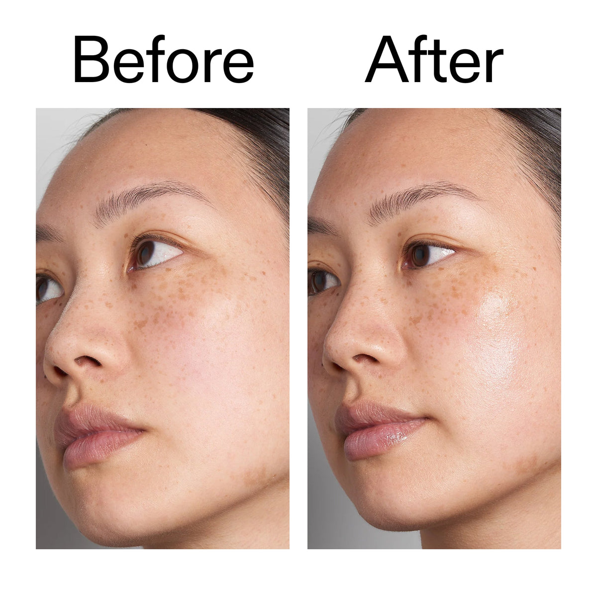 hyaluronic-acid-serum-60ml-duo-k8 Hyaluronic_Acid_Before_After_2000x2000_d566f5ba-a77e-4585-99fd-0f4682b164dd.jpg