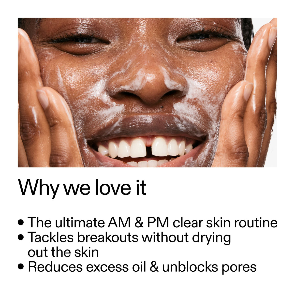 intro-routine-for-acne-y1 Intro_Routine_for_Acne_Why_we_love_it_2000x2000_42499e10-4629-4a0e-a627-7e215f4da6bc.jpg