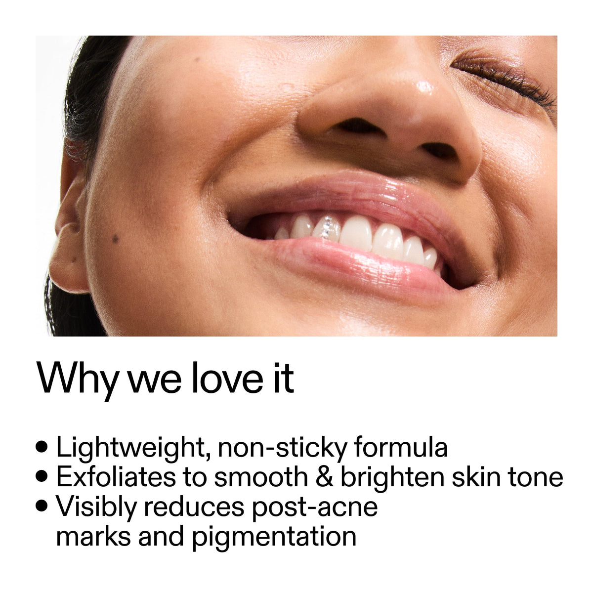 mandelic-acid-treatment-h4 Mandelic_Acid_Treatment_Why_we_love_it_2000x2000_6dfe29a9-2a79-464f-a5e8-e5ac37d93388.jpg