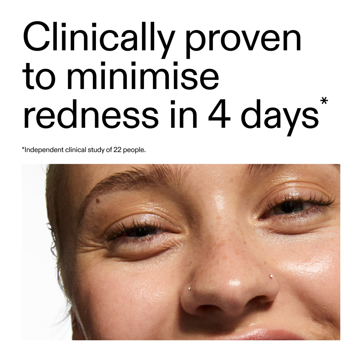 10-azelaic-acid-serum-for-redness-relief-o5 Oat_Cleansing_Balm_Claim_2000x2000_52a841dc-353c-4f2c-8646-3aadb604507d.jpg