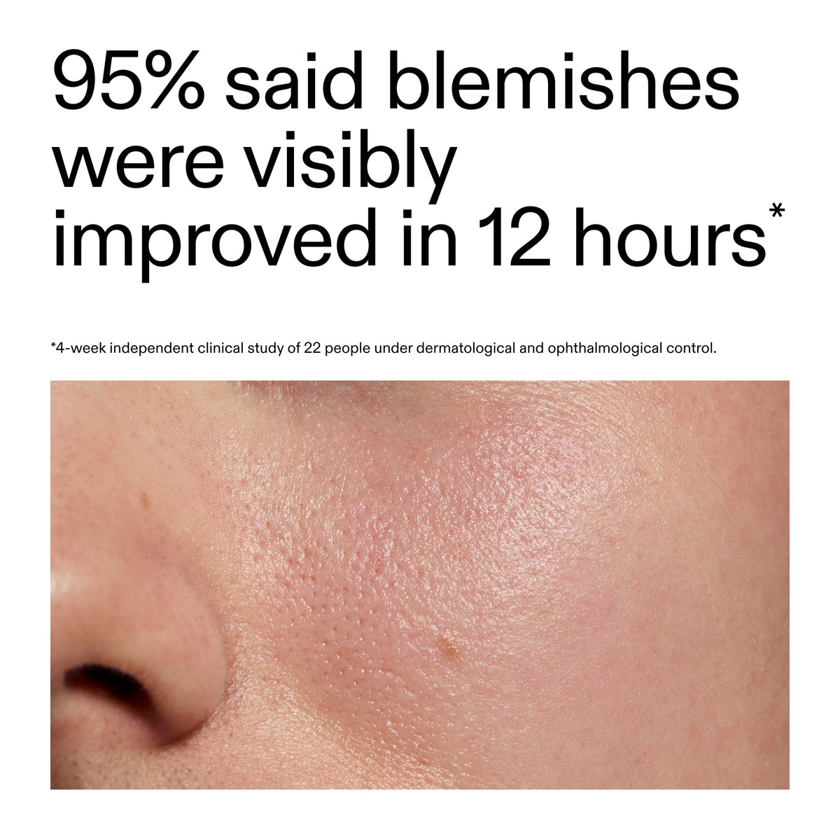 succinic-acid-acne-treatment-l3 Oat_Cleansing_Balm_Claim_2000x2000_ac6ce553-25db-41b2-a981-faae1ac4b8c0.jpg