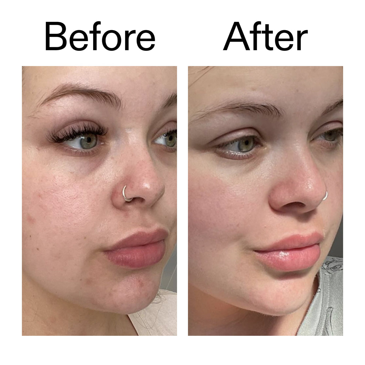 omega-water-cream-50ml-v3 Omega50_Before_After_2000x2000_46483ed8-3f9d-487f-9a0c-9df79830bd65.jpg