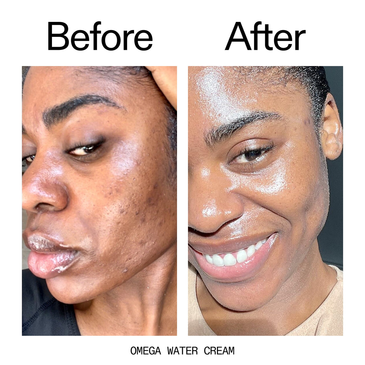 hydrating-cleanser-and-moisturizer-duo-h8 Omega_Water_Cream_Before_After_2000x2000_8e88278b-8c8d-48dc-ac77-4e98ebbd1b77.jpg