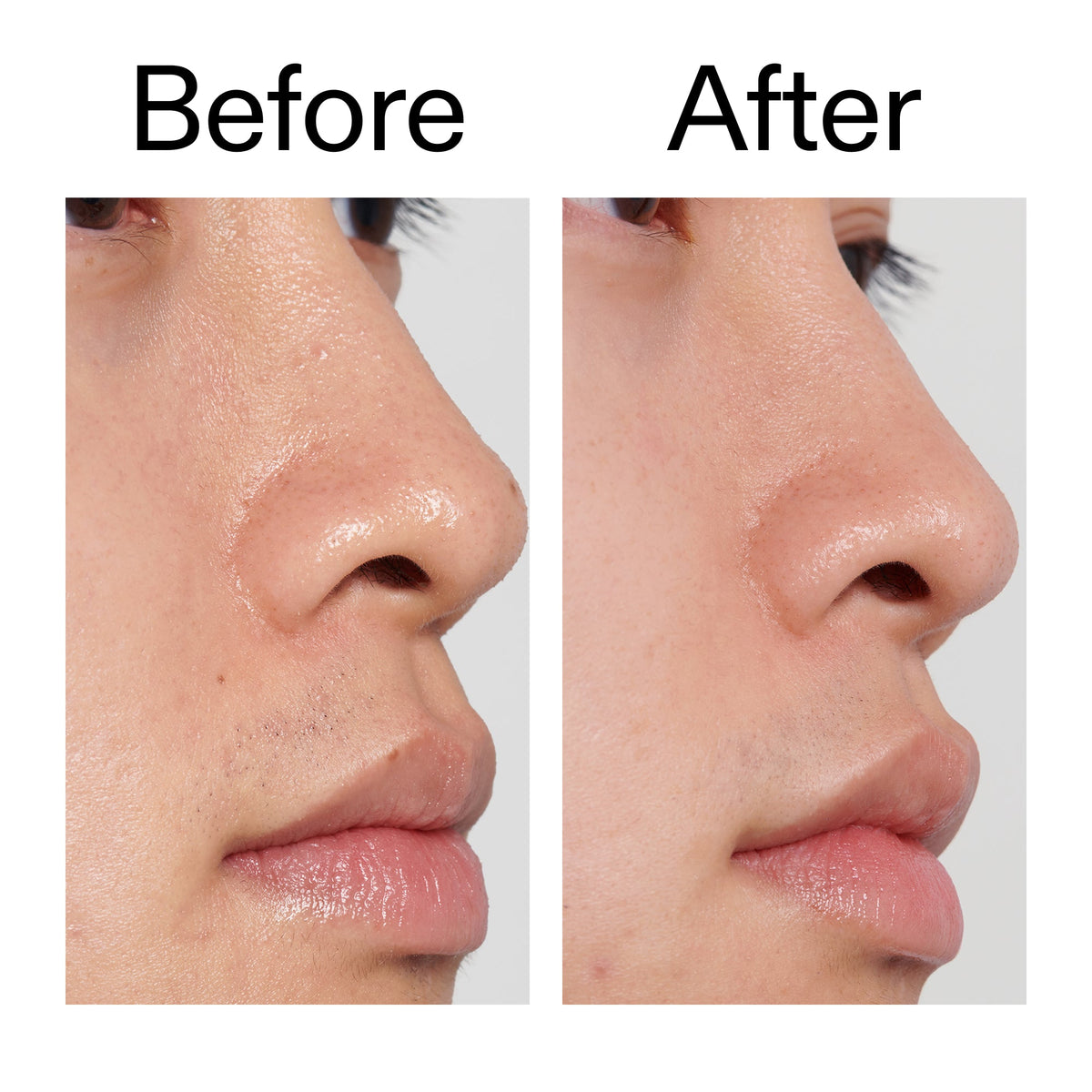 pha-toner-o3 PHA_Toner_Before_After_2000x2000_e3c10172-0150-4342-8b95-57417eaff50d.jpg