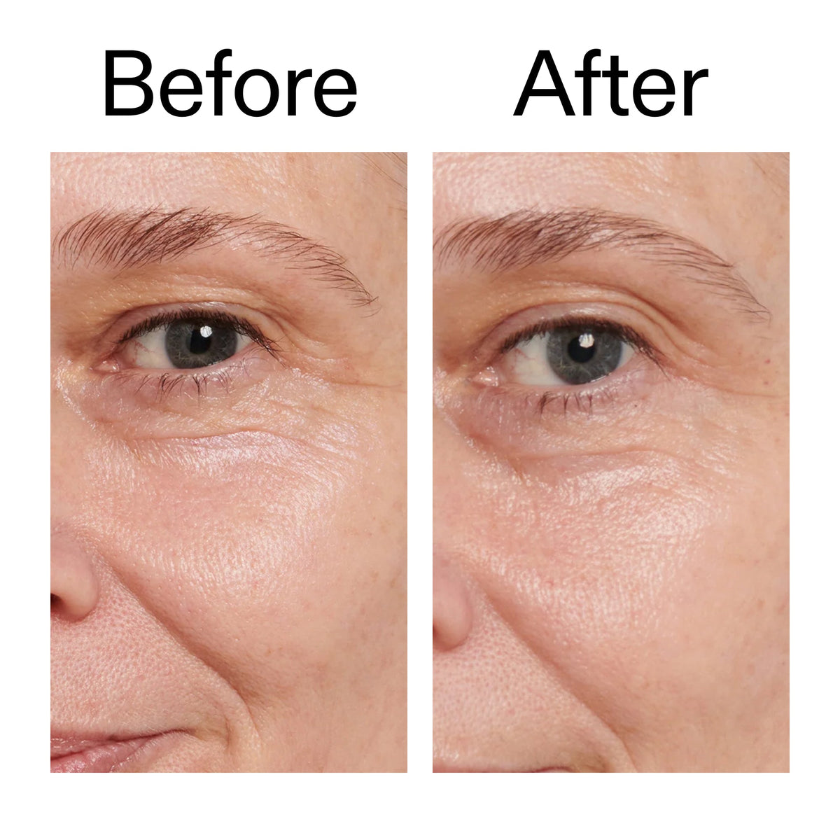 retinol-eye-cream-l1 Retinol_Eye_Cream_Before_After_2000x2000_ac03a80c-109e-4572-a95a-91dc109b4d27.jpg