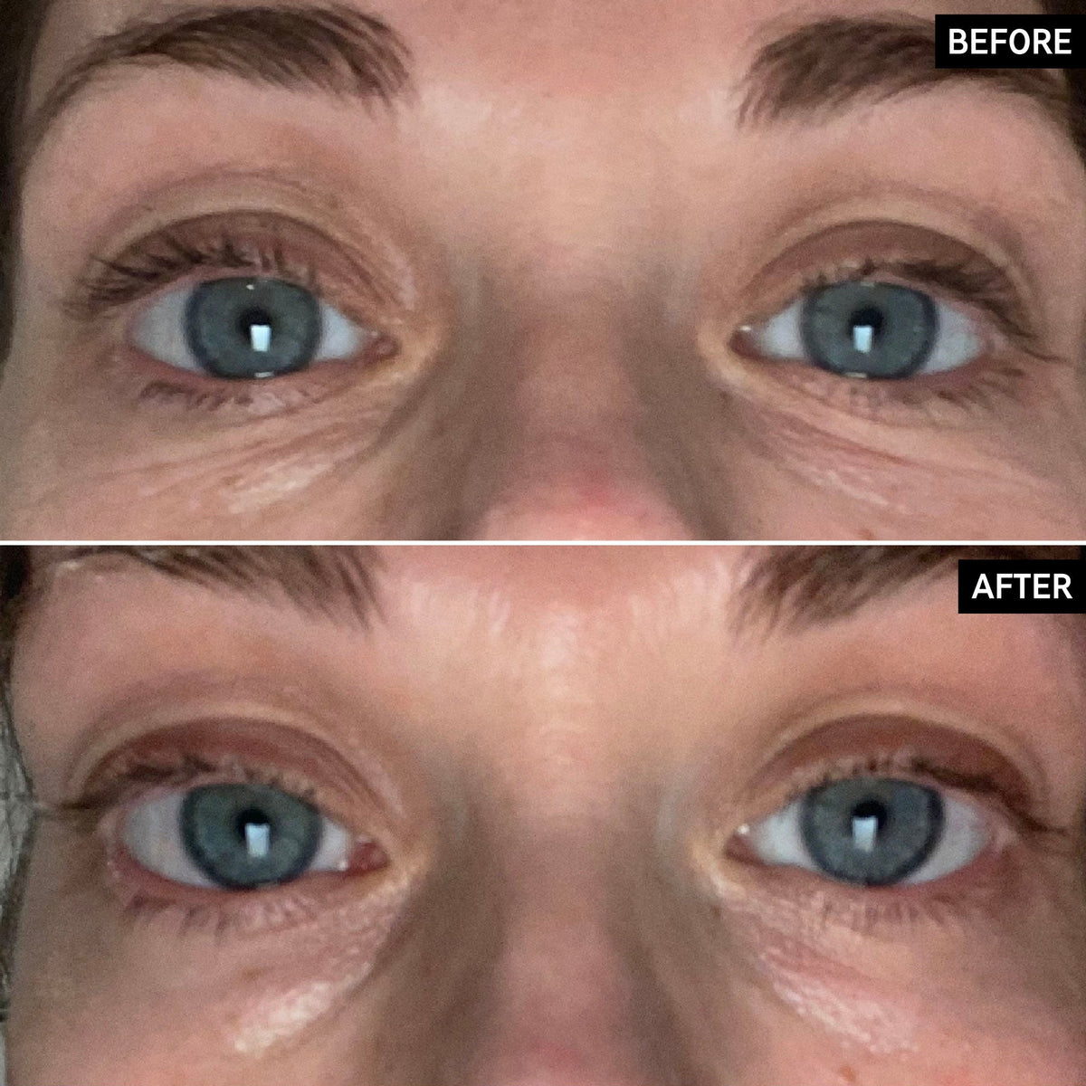 retinol-eye-cream-l1 SITE-UGCBAsApril_Nicole_B_A_PPage_2000x2000_1.jpg