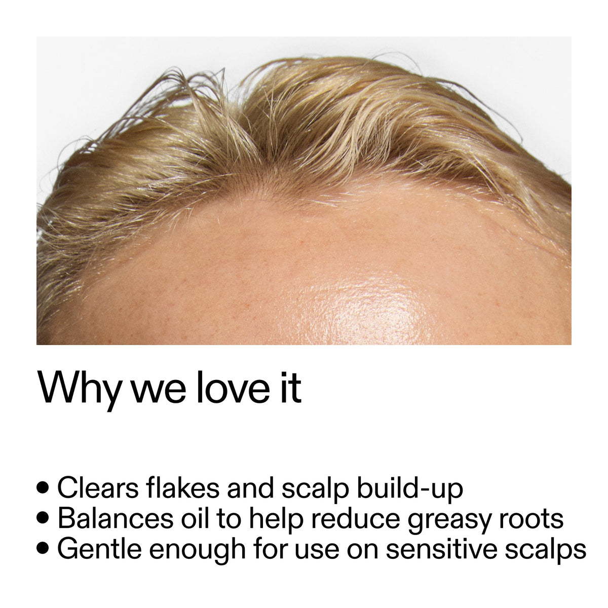 salicylic-acid-exfoliating-scalp-treatment-s5 Salicylic_Acid_Exfoliating_Scalp_Treatment_Why_we_love_it_2000x2000_44b6bd6d-9ec4-4b23-9dc4-bc3fd6f28e14.jpg