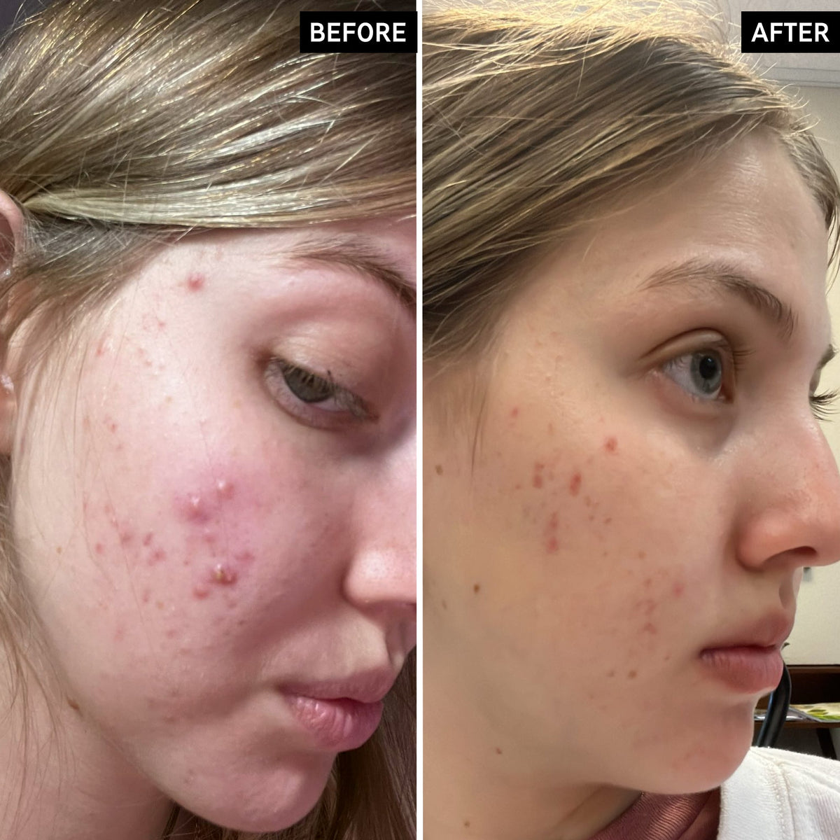 salicylic-acid-cleanser-duo-h8 SamanthaB_A_2000x2000_54062586-cec1-44d9-a20a-bda2c4f03f5f.jpg
