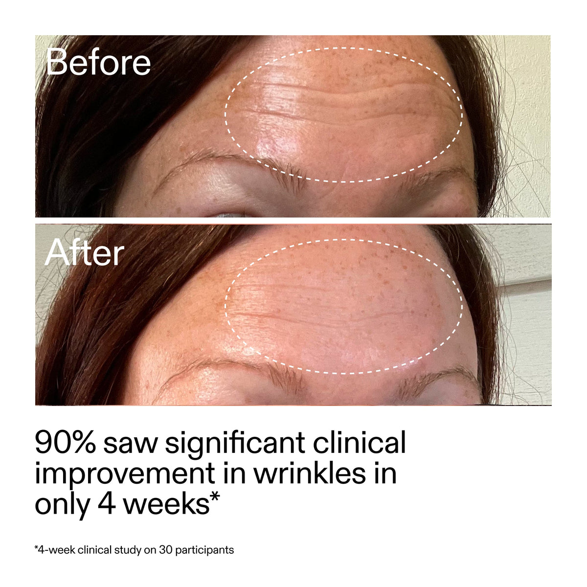 starter-retinol-serum-v8 StarterRetinol_BeforeAfter_Claim1_2000x2000_a09b50b6-4688-4527-abae-21bd142b89b7.jpg