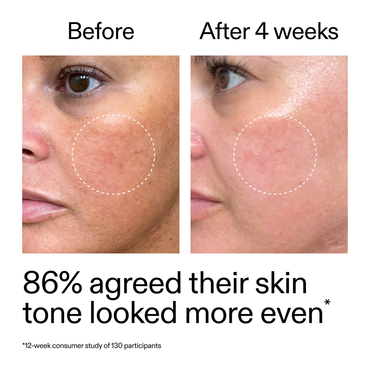 starter-retinol-serum-v8 StarterRetinol_BeforeAfter_Claim2_2000x2000_f5c9ecc0-8d76-429d-bef5-c3a61bcf5c09.jpg