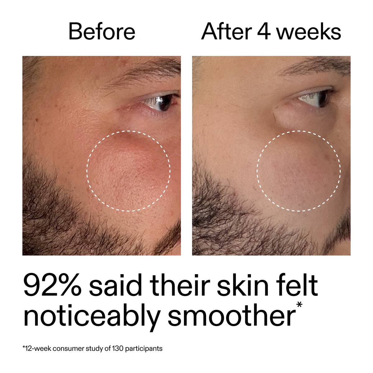 starter-retinol-serum-v8 StarterRetinol_BeforeAfter_Claim3_2000x2000_6ceab106-e0ee-4ed4-ba62-41bc39538038.jpg