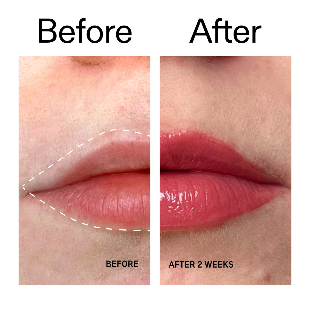tripeptide-plumping-berry-lip-balm-v8 Tripeptide_Plumping_Lip_Balm_-_Berry_Before_After_2000x2000_9474bbd8-43ca-4b0e-b0e7-dfab70b91927.jpg