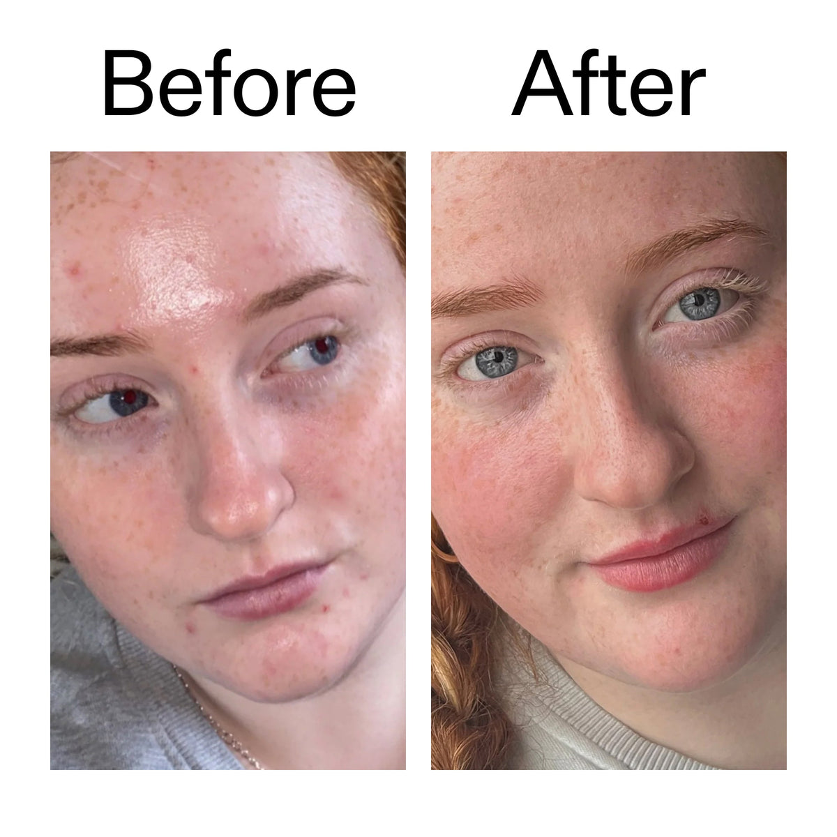 vitamin-b-c-and-e-moisturizer-r9 Vitamin_B_C_and_E_Moisturizer_Before_After_2000x2000_b0781a76-5ad2-4be9-95b8-ef92b356833c.jpg